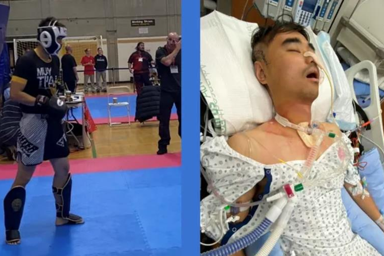  A Chinese student was beaten to death at a Canadian boxing match.  The mother controlled the organizer and asked her son to fight a professional player.

